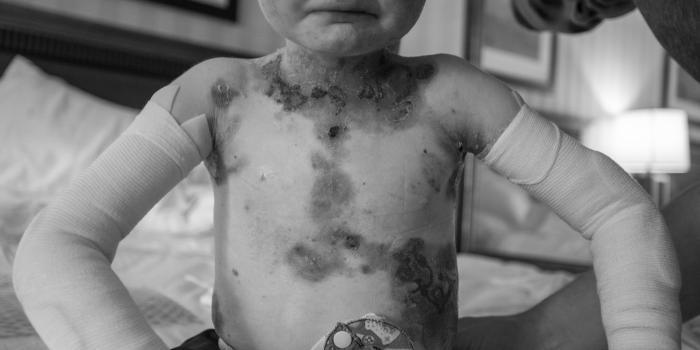 pain and itch