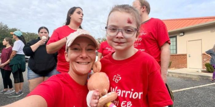 Fundraiser - EB Awareness Week
